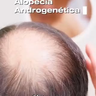 ✨ Tu cabello tiene una historia, y queremos ayudarte a escribir su siguiente capítulo.

Si has notad