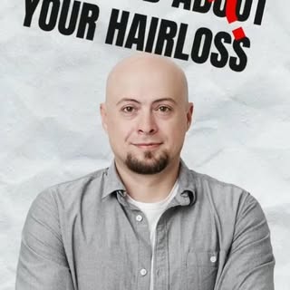 Transform your Look with our Non Surgical Hair Transplant service! Say goodbye to thinning hair and 
