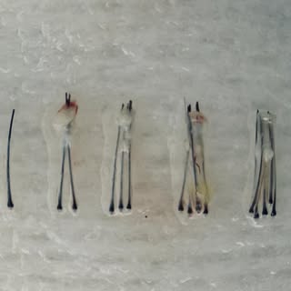 ✨ L’arte del trapianto di capelli inizia qui ✨

Questi piccoli “tesori” sono unità follicolari estra