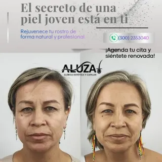 "Un mes después y estoy feliz con los cambios” 💜

Esta es Alejandra. 
Decidió darle un refresh a su