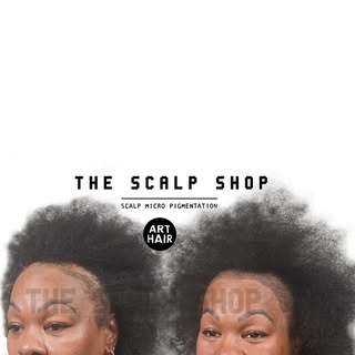 Maisha has a head full of hair, except along her edges. Lace front wigs that were glued down to her 