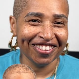 Jocelin was tired of seeing her hair loss everyday in the mirror and after finding @thescalpshop on 