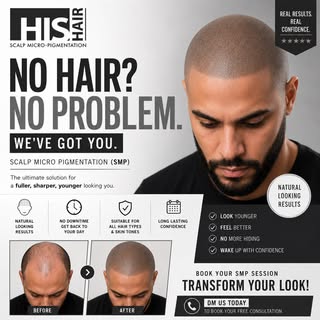 Start the process. 
Be the Best 🏆
Become the Best 🏆
From the Best 🏆
HIS

#HISHAIRCLINIC
#smp #sca