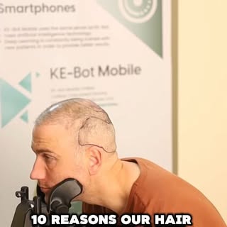 At City Clinics, every hair transplantation procedure is enhanced by one of the most advanced roboti
