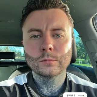 BEARD TRANSFORMATION JOURNEY 🔥

Confidence starts with the details.

Our patient began his beard tr
