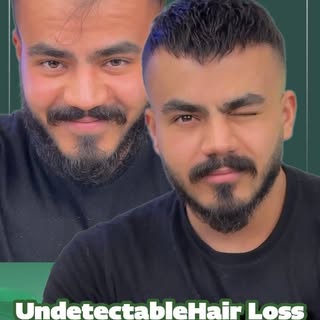 Hair loss doesn’t define you.
A custom hair system does. ✨
Natural look. Real confidence.
By Amin Ha