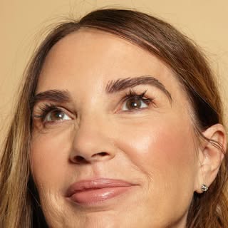 Meet Rosalia, who chose Timeless Hair Transplant to deliver the eyebrows of her dreams. Read Rosalia
