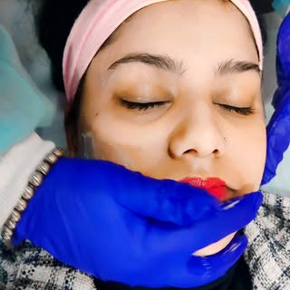 Chemical peels works wonders for 
1. #pigmentation 
2. #acne 
3. #dullskin 
4. #patchyness 
5. #fine