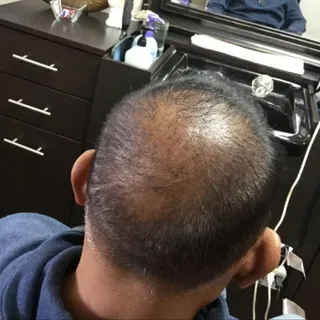 Before