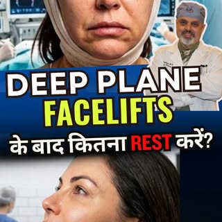 Deep Plane Facelifts के बाद कितना REST करें?
How Much Rest is Needed After a Deep Plane Facelift?

P