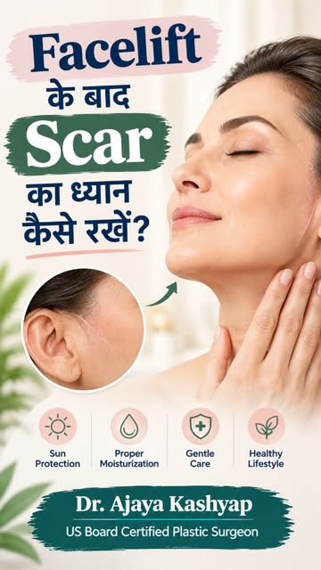 Facelift के बाद Scar का ध्यान कैसे रखें? 

Using your own fat, this approach can help add natural-lo