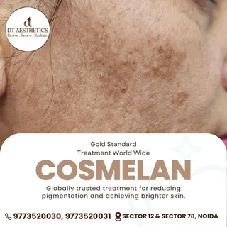 ✨ Pigmentation doesn’t have to define your skin.

Introducing COSMELAN — a globally trusted professi