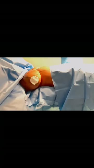 Mamoplastia com mudança de vida!