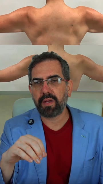 Após perder cerca de 50 kg, é comum que o corpo apresente excesso de pele em algumas regiões, e os b