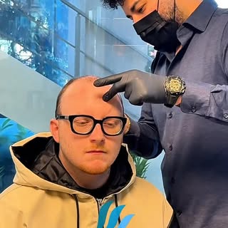 🇮🇹 Our patient from Italy
📍 Operation day

A hair transplant is completed in one day,
but the rea