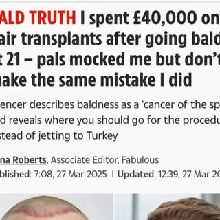 Honesty. Ethics. Advocacy. In a world of noise, Spexhair protects patients and makes sure they get t