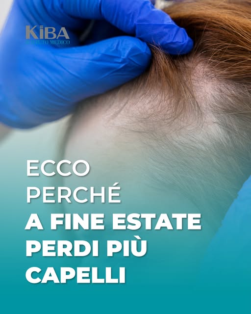 Caduta dei capelli a fine estate: perché può aumentare proprio tra agosto e settembre? 🍂

I capelli