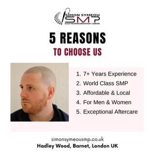 Scalp Micropigmentation Clinic established in Hadley Wood since 2015. Contact Simon Symeou SMP 07398