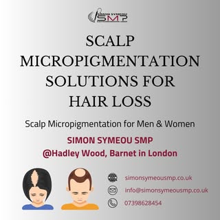 Scalp Micropigmentation is an effective hair loss solution, for men and women. I am proof of this my