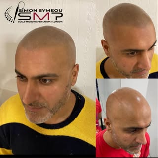 Natural as can be #smp #scalpmicropigmentation #scalptattoo #natural #hairtattoo #barbershop #headta
