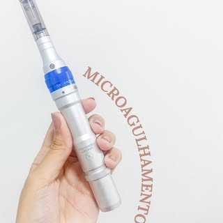 Não é tendência, é resposta biológica.🧬

Protocolos com 4 sessões de microagulhamento podem intensi