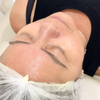 Bora acompanhar um protocolo com o peeling 4D da @ellementtidermocosmeticos comigo?✨

Mais do que pr
