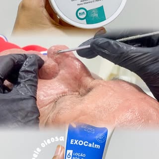 Bora acompanhar mais uma limpeza de pele comigo?🧴🫧

Cada etapa dessa limpeza foi pensada para aten