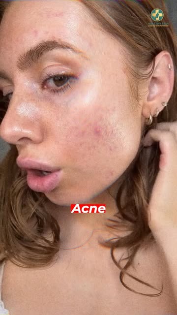 Struggling with pigmentation or uneven-looking skin?

Don’t just cover it—understand your skin and b