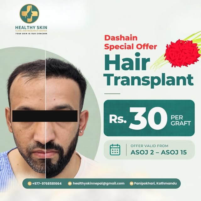 Your hair transformation starts here!

Get your dream hair with a special Hair Transplant offer at j