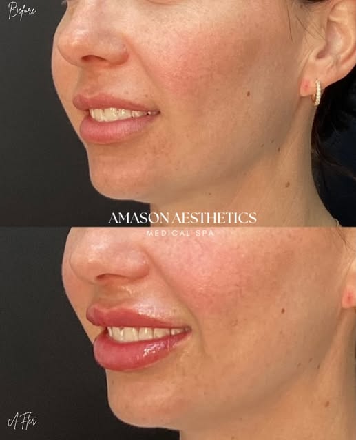 These results speak for themselves. 👏

Refreshed. Balanced. Natural.

The goal isn’t to look “done”