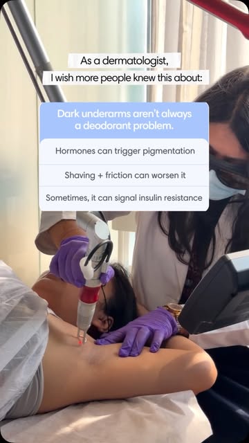 Pigmentation isn’t always what it seems. 👀

From pregnancy-related melasma to dark underarms and kn