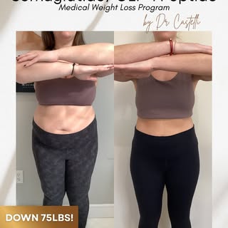 🏅DOWN 75 POUNDS on our GLP-1 / Semaglutide program💪

On average you can lose 15-20% of starting bo