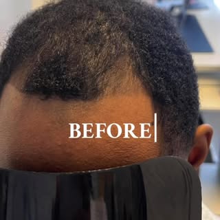 You keep wearing hats…

Not because you want to—but because you’re trying to hide your hairline.

If