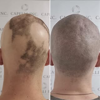 Different Before & After Styles - Capelli Inc Magic 🐍

Scalp Micropigmentation -
No1 Hairloss Solut