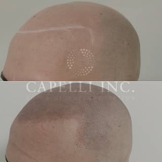 Don’t miss out on your Scalp Micropigmentation SMP with Ant @ Capelli Inc 

👀🫵