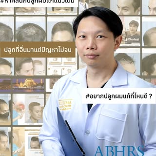 รีวิวปลูกผมแก้ไขเคสมีปัญหา
.
#ปลูกผมเน้นคุณภาพ โดยแพทย์อเมริกันบอร์ด #ABHRS
📌 สอบถามข้อมูลกับคุณหมอ