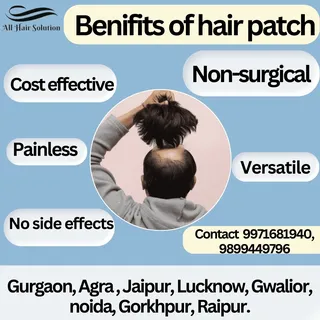 BENIFITS OF HAIR PATCH !!!

Our Branches : Gurgaon, Agra, Noida, Jaipur, Lucknow, Gwalior
Contact us
