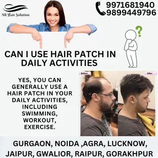 ABOUT HAIR PATCH!!!

Our Branches : Gurgaon, Agra, Noida, Jaipur, Lucknow, Gwalior
Contact us : 9899