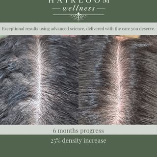 Are you starting to see more of your scalp when you look in the mirror? Is there more hair in your b