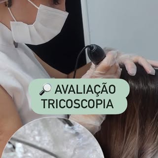 A avaliação tricoscópica capilar é um exame não invasivo que permite analisar detalhadamente o couro