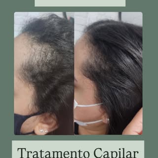 O tratamento capilar te ajuda a recuperar não só a auto estima, mas a esperança de ter seu cabelo de
