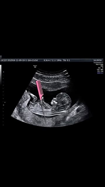 Uma imagem minha rara, lá no início 🤣🤣🤣
.
.
#meme #cabeleireiro #baby