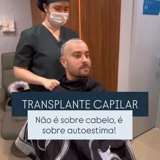 TRANSPLANTE CAPILAR, resgatando não apenas os cabelos, mas a autoestima dos nossos pacientes! #trans
