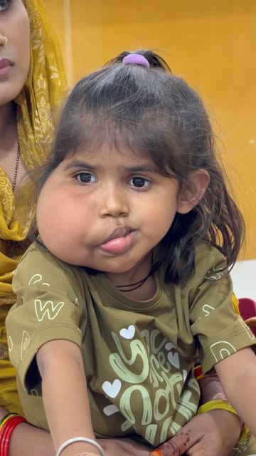 A young patient presents  with significant facial swelling.
@richardsons_face_hospitals 
@drsunilric