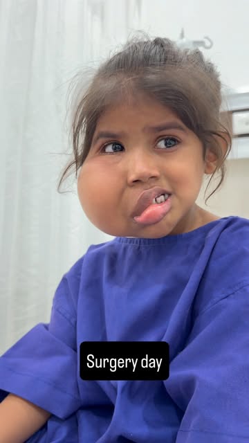 A little girl with diffuse lipomatosis involving right side of the face -surgery day 

@richardsons_