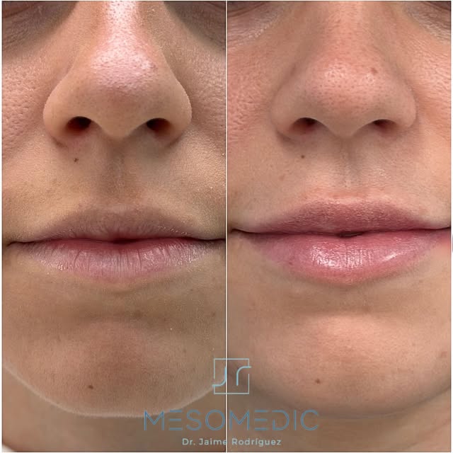 Después del verano, nuestros labios también necesitan recuperar su mejor versión. ☀️👄

En este caso