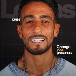 ✨ Another Amazing Transformation! ✨

Patient: Driss Choukrani 🦷
📅 Arrival Date: 07.07.2026
📅 Depa