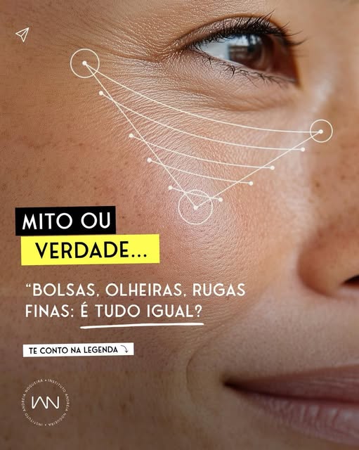 MITO ✔️Bolsas, olheiras e rugas finas são condições distintas na região dos olhos que possuem causas