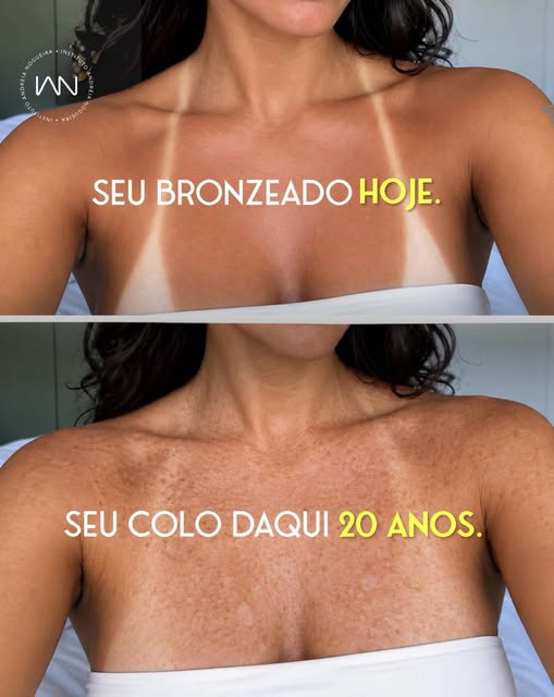 O bronzeado pode até ser bonito, mas a exposição solar sem proteção cobra um preço da pele ao longo 