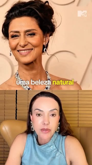 Os fios de sustentação podem ser um excelente recurso para reposicionar os tecidos sem criar volume,